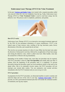 Endovenous Laser Therapy (EVLT) for Veins Treatment
