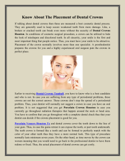Know About The Placement of Dental Crowns