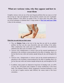 What are varicose veins