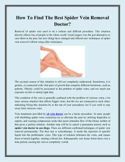 How To Find The Best Spider Vein Removal Doctor