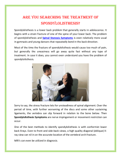 Are You Searching The Treatment of Spondylolisthesis