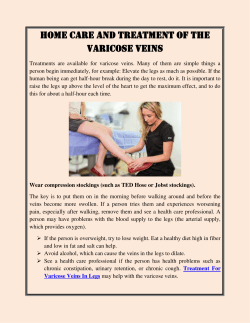 Home Care and treatment of the Varicose Veins